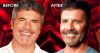 agt-simon-cowell-face-before-after-vegan-diet-botox.png