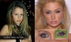 project-monarch-droopy-eyelid-paris-hilton.jpg